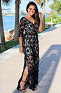 Sexy V-cut Lace Dress Day Dress Holiday Dress